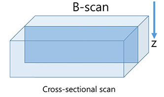 超声波扫描显微镜B-扫描